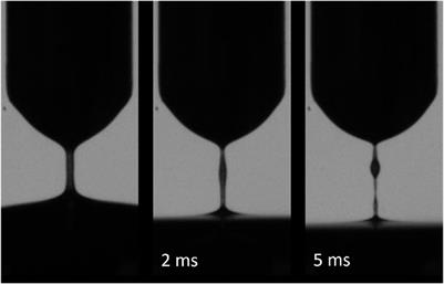 Shear thinning behavior of cerebrospinal fluid with elevated protein or cellular concentration